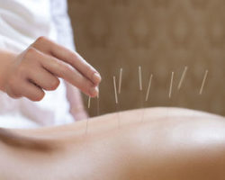 3 Safety Lessons Anatomy Acupuncture