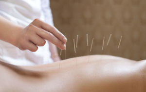 3 Safety Lessons Anatomy Acupuncture