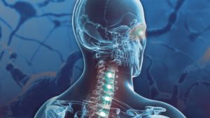 Acupuncture Courses Online 8 Things You Need to Know About CNS Tumors
