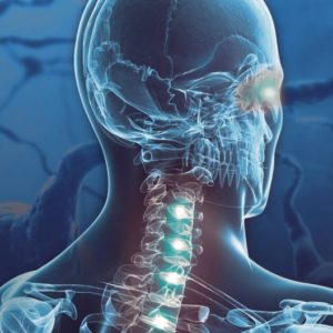 Acupuncture Courses Online 8 Things You Need to Know About CNS Tumors