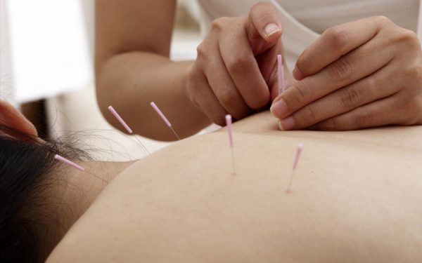 Acupuncture NCCAOM Safety Course