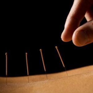 Acupuncture ceu online