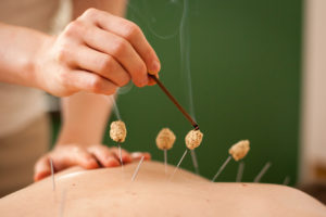 Acupuncture Continuing Education Moxibustion