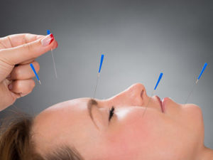 Eczema Acupuncture