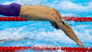 Michael Phelps Cupping