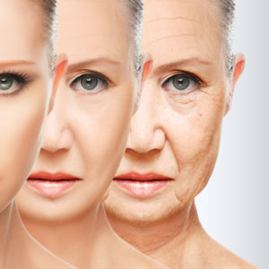 Skin Aging