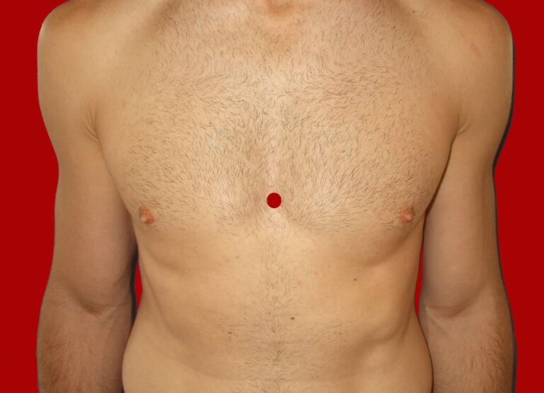 What You Must Know About Depression & Acupuncture | Acupuncture