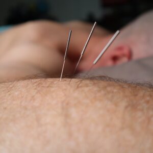 Acupuncture CEUs Japanese acupuncture