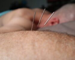 Acupuncture CEUs Japanese acupuncture