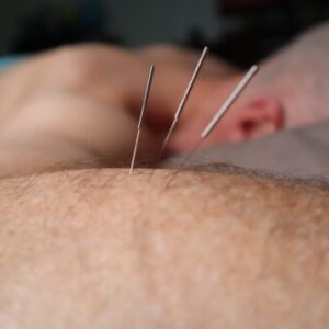 Acupuncture CEUs Japanese acupuncture