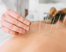 Acupuncture Continuing Education for Sports Injuries CEUs:PDAs