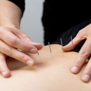 “3 Concepts” - Acupuncture, TCM, & Autoimmune Disease