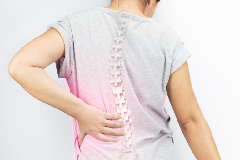 “#1 - 10 Lessons” - Scoliosis & Western Medicine - 7 Acupuncture CEUs/PDAs