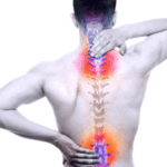 16 CEUs All About Degenerative Disc Disease